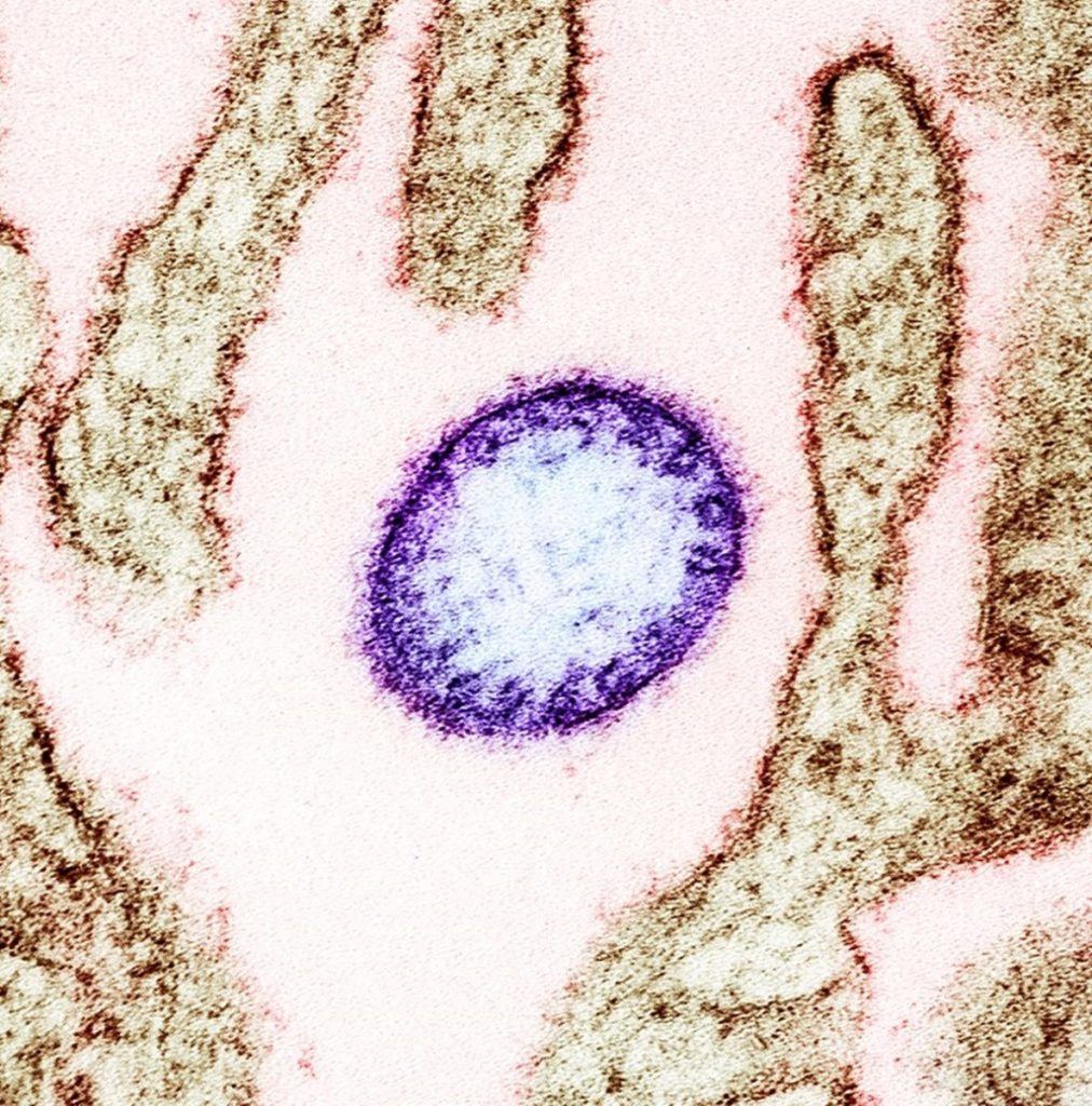 OMS minimizează riscul de răspândire a virusului Nipah din India, în ciuda noilor cazuri raportate Organizația Mondială a Sănătății (OMS) a emis vineri o declaratie în care afirmă că pericolul de răspândire a virusului Nipah din India a fost redus semnificativ, în ciuda apariției recente a două cazuri de infectare într-una dintre cele mai populate țări ale Asiei de Sud
