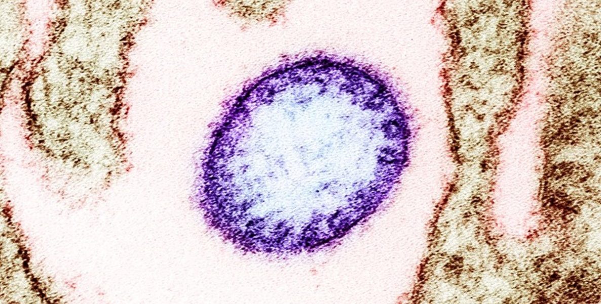 virus-Nipah.jpg - StiriAlese