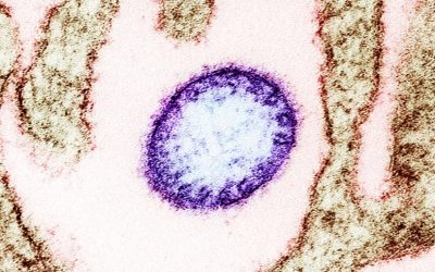 virus-Nipah.jpg - StiriAlese