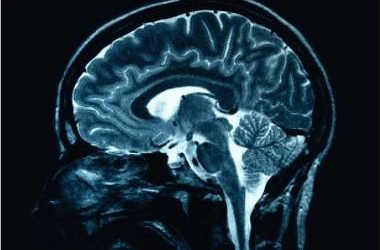Cercetătorii americani dezvăluie instrument AI pentru predictia Alzheimer cu 93% precizie