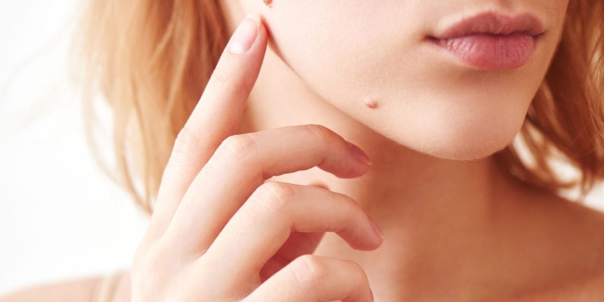 De-ce-apar-alunitele_shutterstock_Descopera-10.jpg - StiriAlese