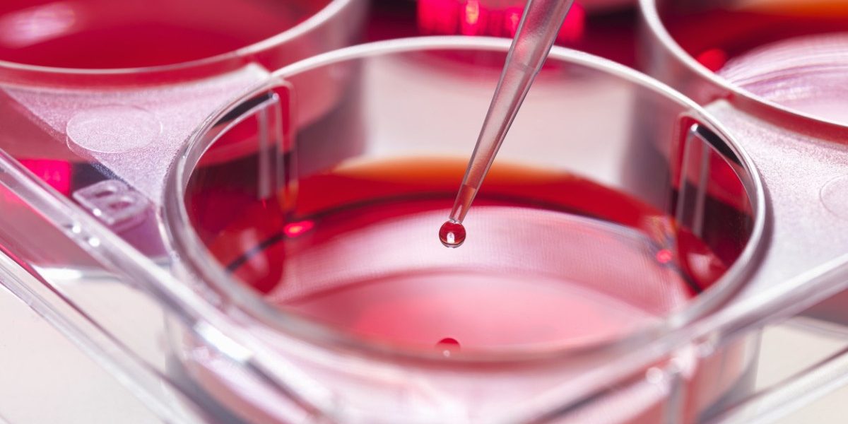 Jmhhc2g9ZjQ4OWE3ZTVlOWYwNmRlZjgyOWM1OTlmNGVkZWZjOTM.thumb_.jpg - StiriAlese