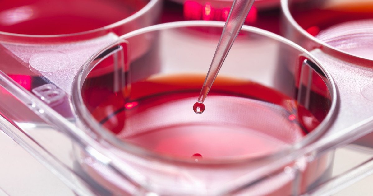 Evoluție în tratamentul leucemiei mieloide acute: noile cercetări permite personalizarea terapiilor Cercetători din domeniul hematologiei au anunțat recent o descoperire promițătoare care ar putea revoluționa modul în care este abordată leucemia mieloide acute (LMA)