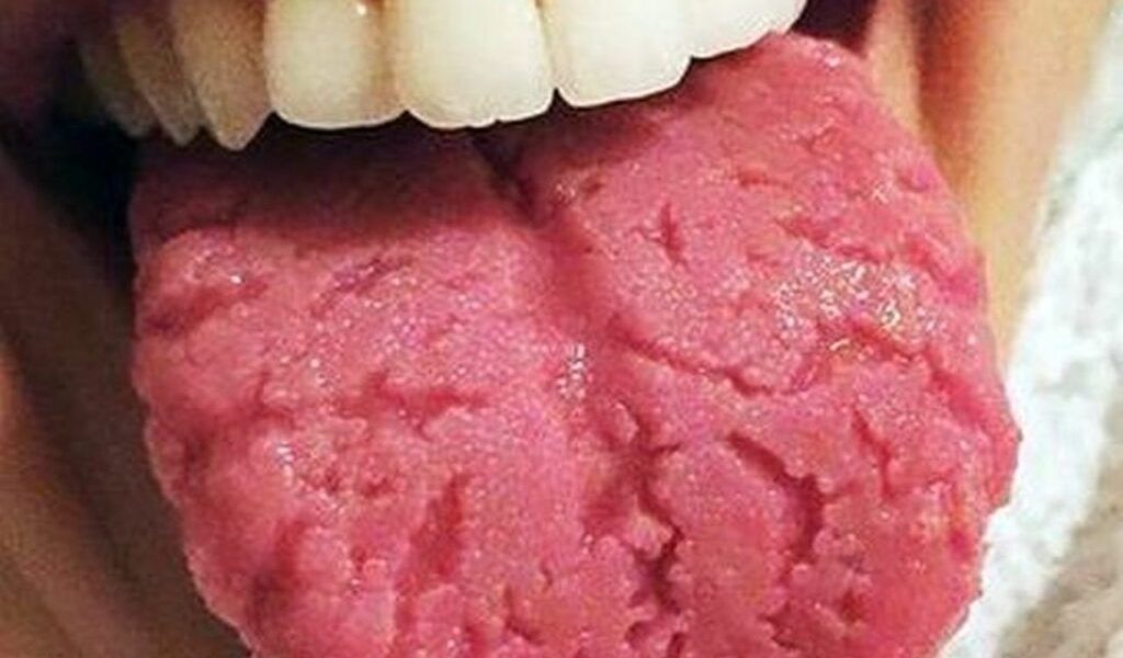 Limba-crapata-1024x758.jpg - StiriAlese