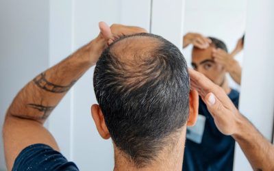 Cercetători au dezvoltat în laborator foliculi de păr funcționali