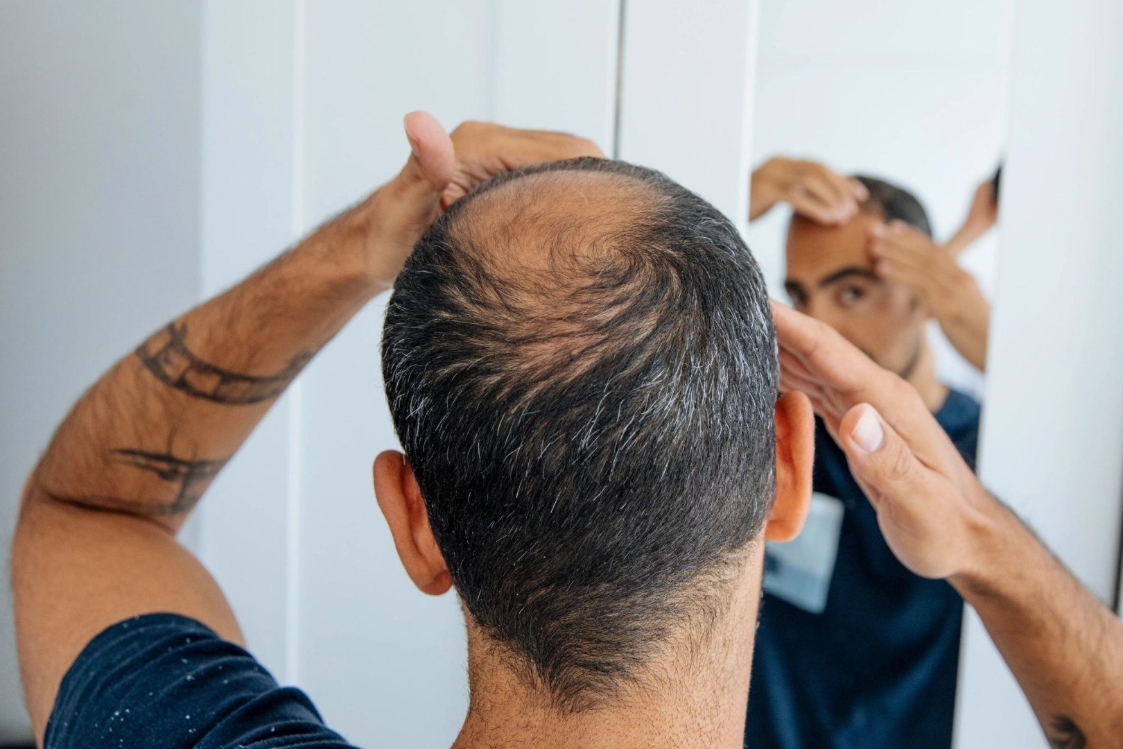 O descoperire revoluționară în domeniul medicinii regenerative a adus speranțe în lupta cu alopecia, oferind o perspectivă nouă asupra posibilității de a reconstrui foliculii de păr la nivel laboratory