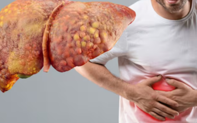 ficat-gras-1024x575.png - StiriAlese