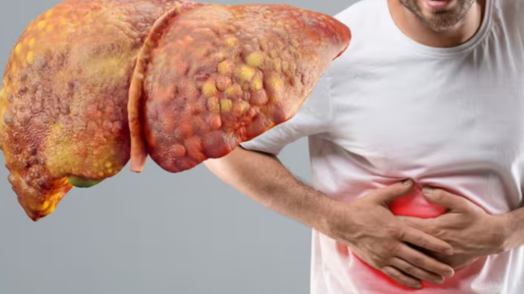 ficat-gras-1024x575.png - StiriAlese