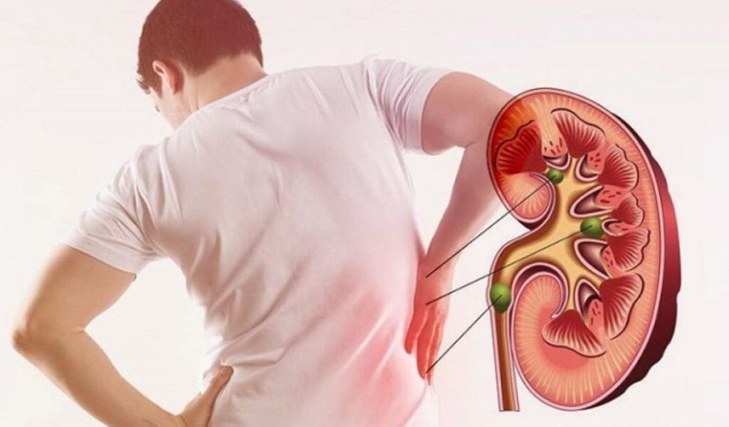 piatra-la-rinichi-1024x682.jpg - StiriAlese