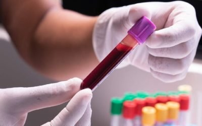 test-de-sange-1024x455.jpg - StiriAlese