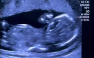 Gravidă, umilită la Filantropia din București: Pleacă la tratament în Germania