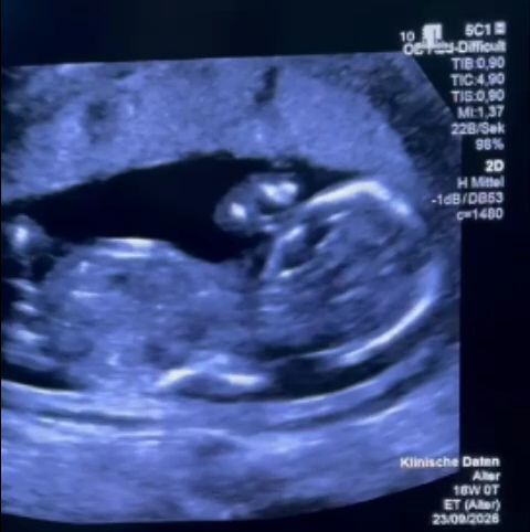 Gravidă, umilită la Filantropia din București: Pleacă la tratament în Germania