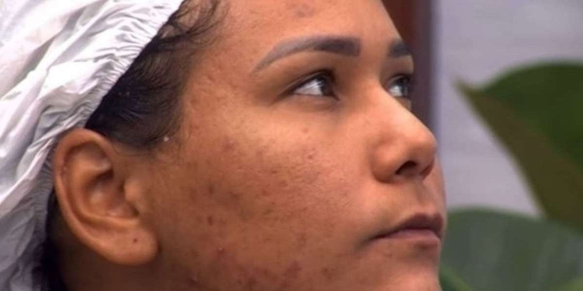 quais são os cuidados ideais para quem tem, como Chaiany, eliminada do 'BBB 26'? Cosmetóloga faz alerta e revela hábito indispensável na rotina de skincare