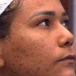 quais são os cuidados ideais para quem tem, como Chaiany, eliminada do 'BBB 26'? Cosmetóloga faz alerta e revela hábito indispensável na rotina de skincare