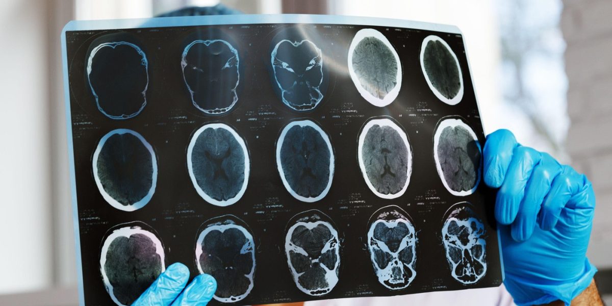 aGFzaD0wMWY1YzUxNWQ0NjdjNjZhMzc4YzgzYmRlODU5MzlhZQ.thumb_.jpg - StiriAlese