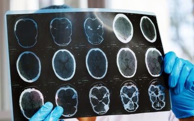 aGFzaD0wMWY1YzUxNWQ0NjdjNjZhMzc4YzgzYmRlODU5MzlhZQ.thumb_.jpg - StiriAlese