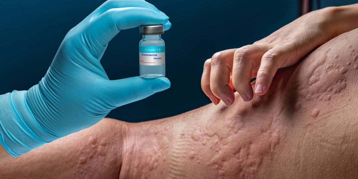 alergii.jpg - StiriAlese