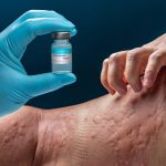 alergii.jpg - StiriAlese