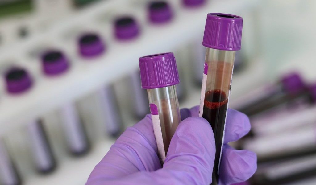 Analiză de sânge revoluționară: depistează cancerul înainte de simptome