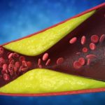 7 semne vitale ignorate: Cardiologii avertizează asupra arterelor blocate!