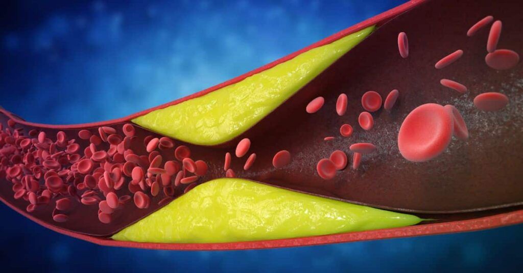7 semne vitale ignorate: Cardiologii avertizează asupra arterelor blocate!