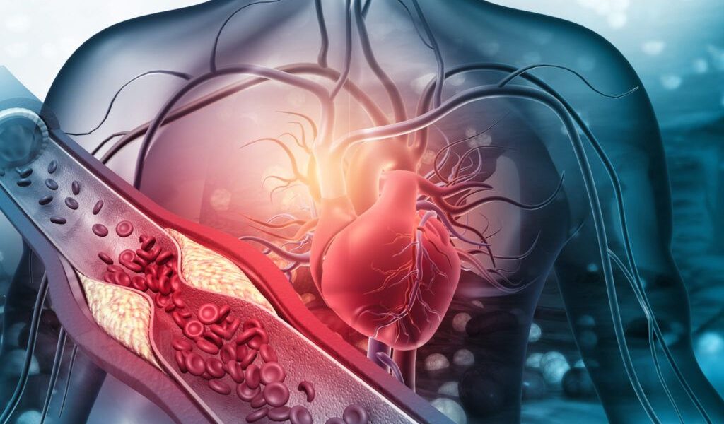 Prevenția Cardiovasculară: O Prioritate Vitală pentru Sănătatea Populației Boli cardiovasculare, precum infarctul miocardic și accidentul vascular cerebral (AVC), reprezintă o cauză majoră de deces la nivel mondial, dar riscul asociat acestora poate fi semnificativ redus prin măsuri preventive