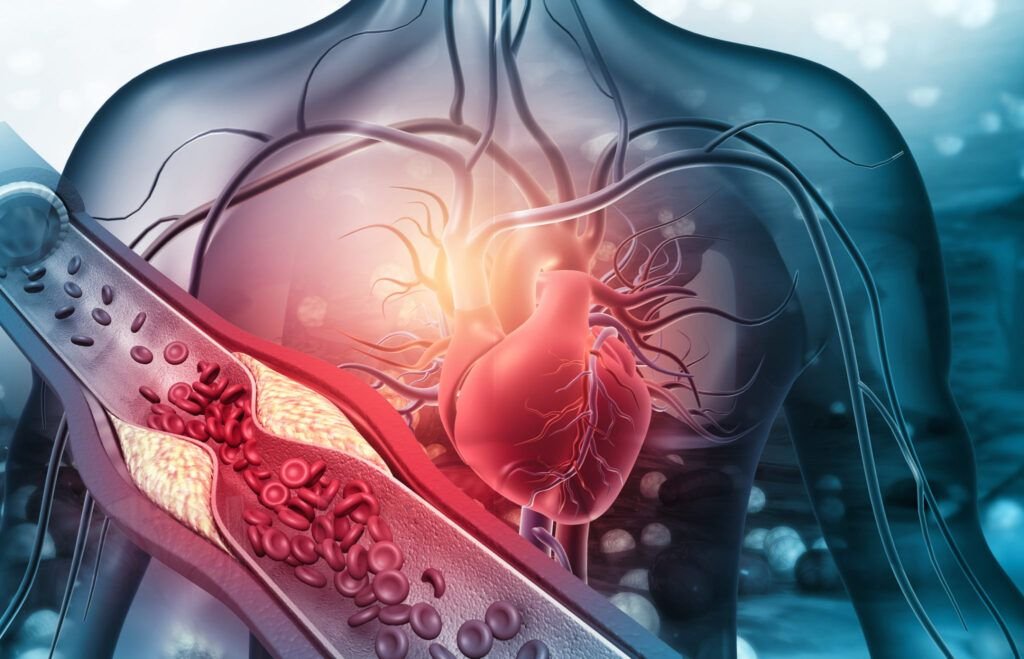 Prevenția Cardiovasculară: O Prioritate Vitală pentru Sănătatea Populației Boli cardiovasculare, precum infarctul miocardic și accidentul vascular cerebral (AVC), reprezintă o cauză majoră de deces la nivel mondial, dar riscul asociat acestora poate fi semnificativ redus prin măsuri preventive