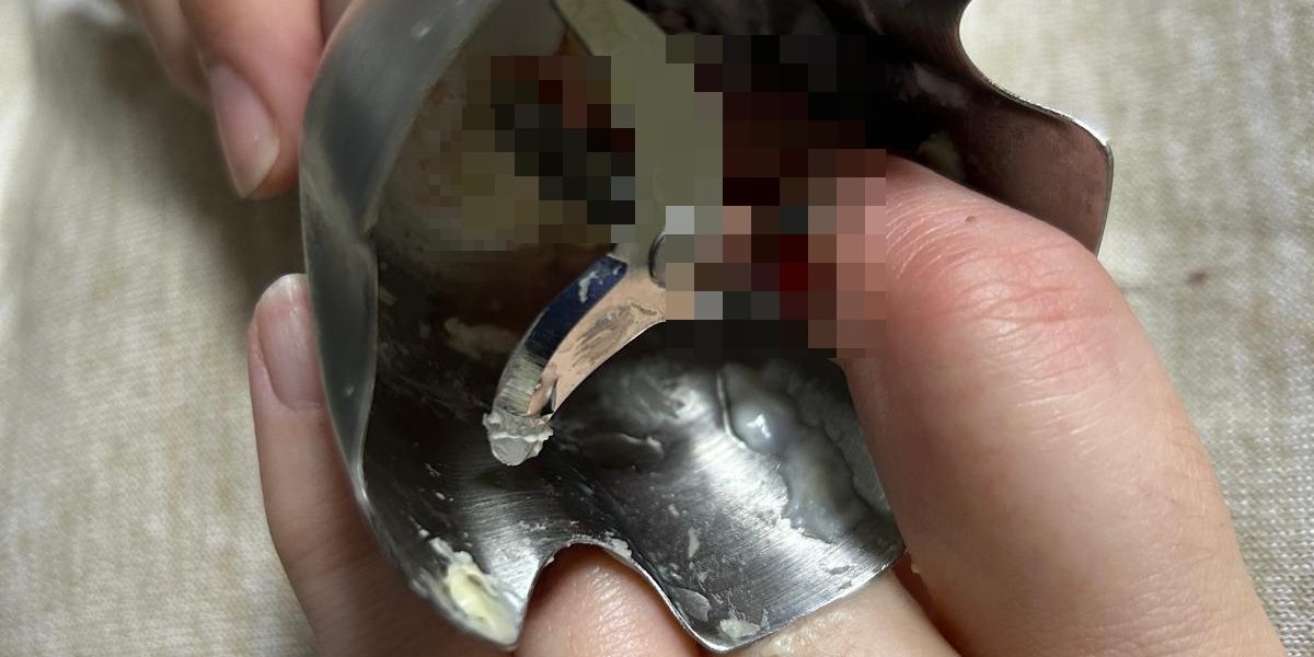 Două femei din Iași, victime ale unor accidente casnice grave