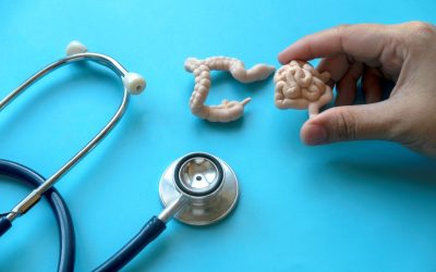 Cancerul de colon lovește tineri! De ce fenomenul îngrijorează planeta