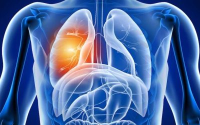 Plămânii, afectați după COVID-19: Ce efecte ascunde boala?