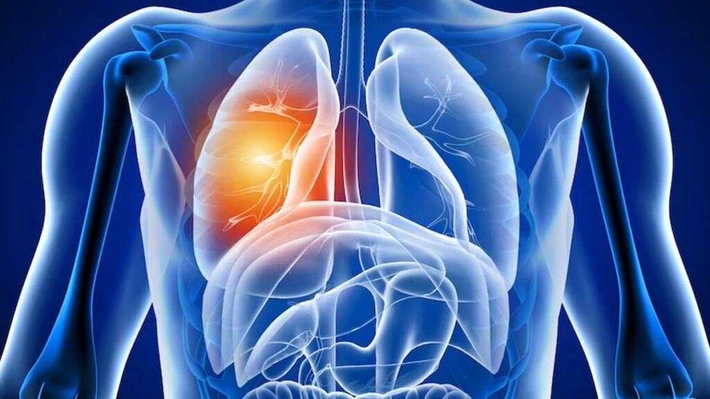 Plămânii, afectați după COVID-19: Ce efecte ascunde boala?