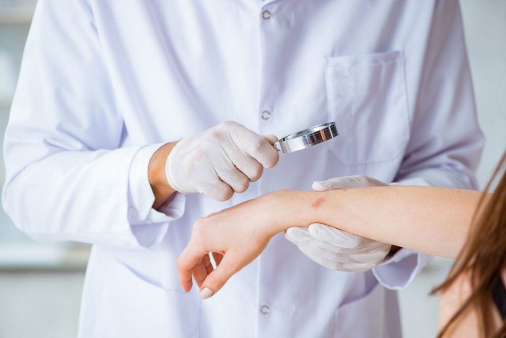 Ectima, infecția cutanată care te poate afecta: Cauze și tratamente