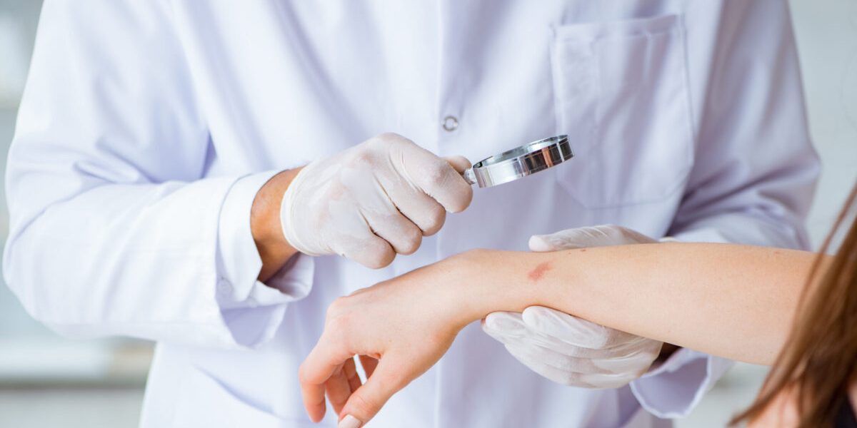 Ectima, infecția cutanată care te poate afecta: Cauze și tratamente