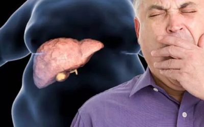 Boală ficat gras: Tratament inovator, fără dietă. Descoperirea cercetătorilor