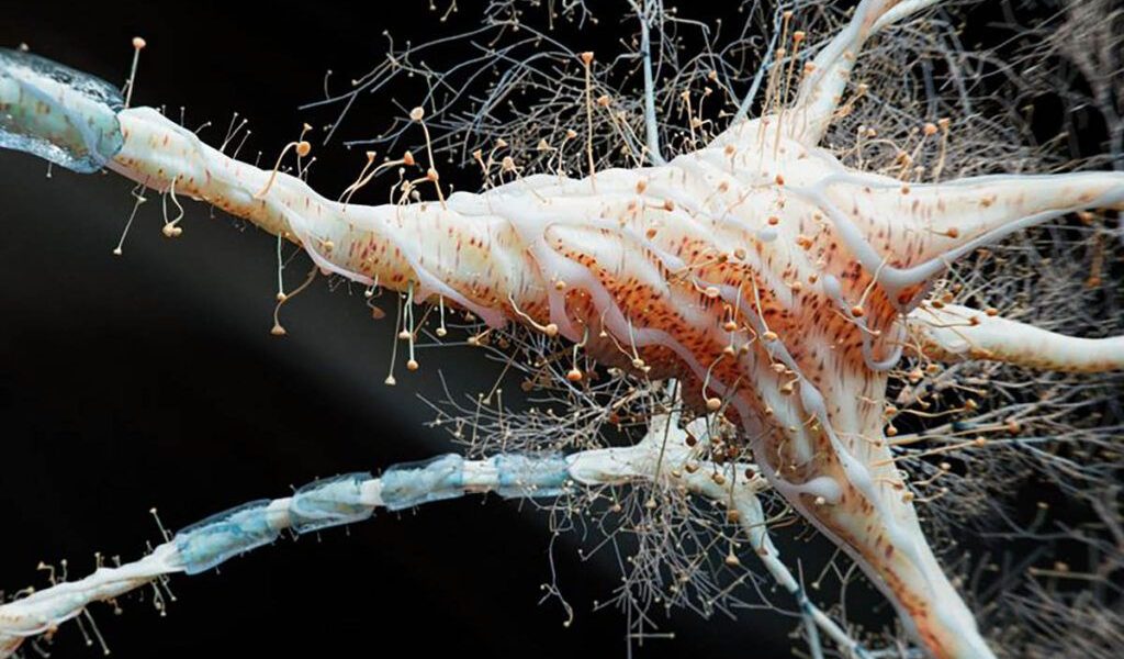 NOI DESCOPERIRI: Inima Sclerozei Multiple S-ar Putea Ascunde în Intestin Un studiu recent schimbă radical modul în care oamenii de știință înțeleg scleroza multiplă (SM)