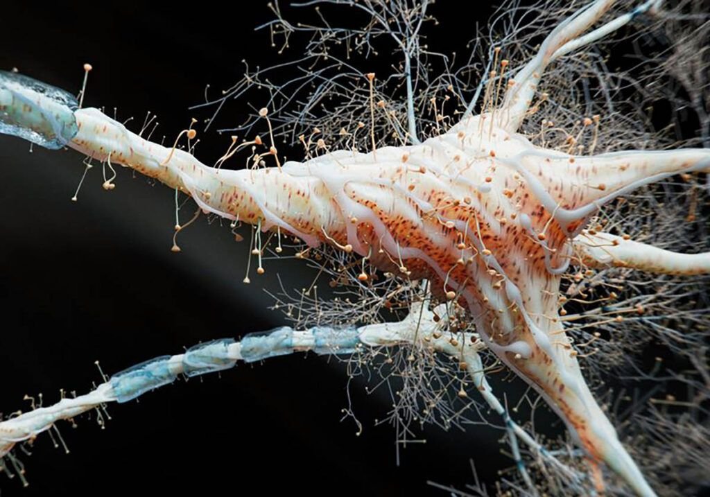 NOI DESCOPERIRI: Inima Sclerozei Multiple S-ar Putea Ascunde în Intestin Un studiu recent schimbă radical modul în care oamenii de știință înțeleg scleroza multiplă (SM)