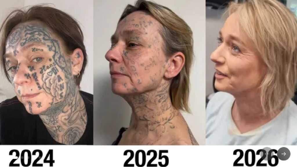 Olandeză, marcată cu 250 de tatuaje cu numele fostului iubit pe față