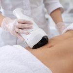 liposuctia.jpeg - StiriAlese