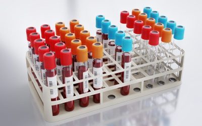 Analiză SÂNGELUI, mai precisă ca colesterolul: cine riscă infarct sau AVC