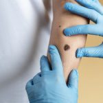 O aluniță fatală: O FEMEIE a murit după o intervenție șocantă