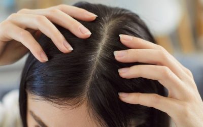 Păr rar sau căderea masivă? Cauze ascunse, ignorate de mulți