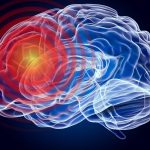 Nouă tulburare neurologică, mister total: Ce se întâmplă cu creierul