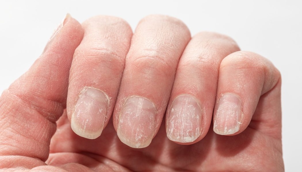 unghii.jpg - StiriAlese