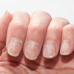 unghii.jpg - StiriAlese