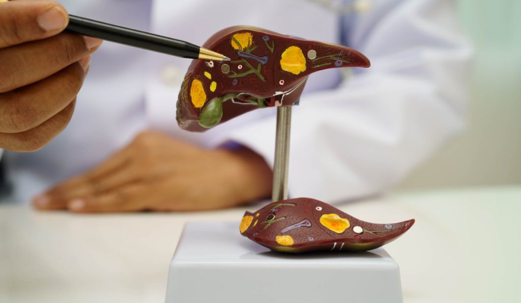 Boala ficatului gras: Atentie la acest „simptom” ascuns!