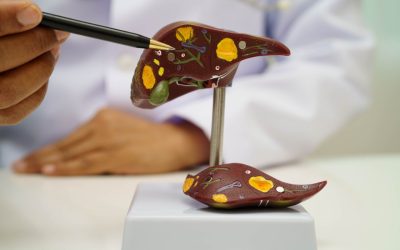 Boala ficatului gras: Atentie la acest „simptom” ascuns!