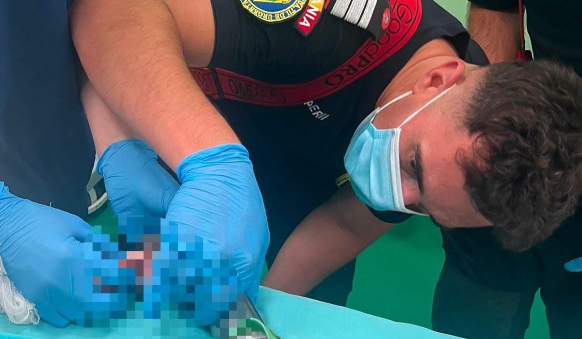 Pompierii salvează un copil de 2 ani blocat într-o mașină de tocat