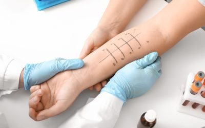 Intoleranță alimentară: Semnele și când te adresezi medicului