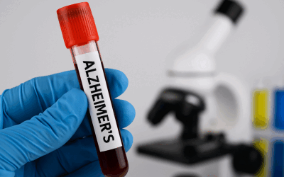 Alzheimer, transmis prin sânge? Un studiu șocant dezvăluie pericolul