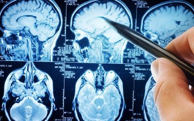 Creierul „vorbește” chiar și-n tăcere. Descoperire medicală majoră